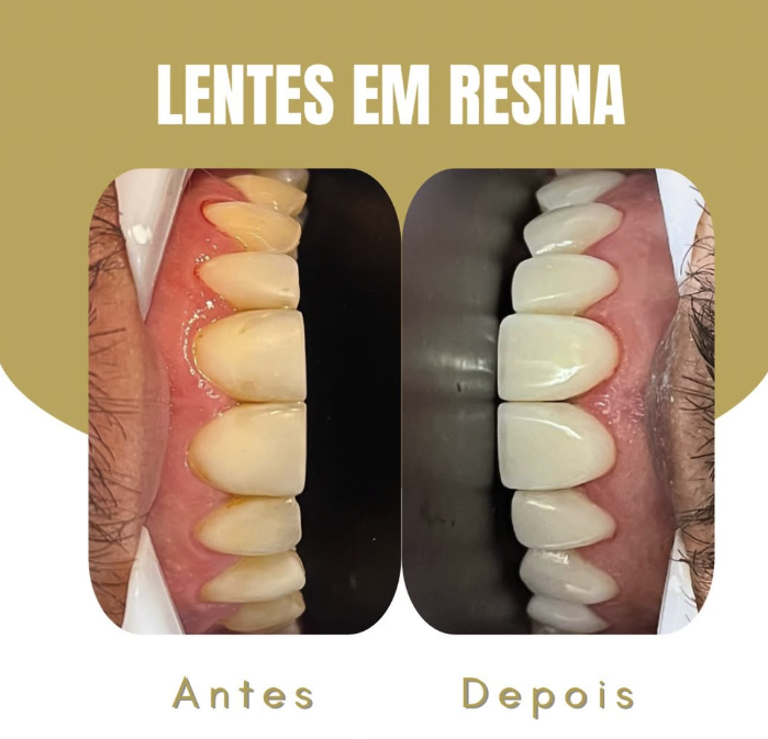 Pedro Morais - Odontologia Especializada