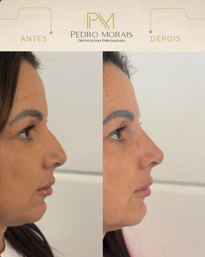 Pedro Morais - Odontologia Especializada