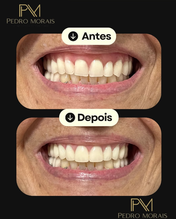 Pedro Morais - Odontologia Especializada